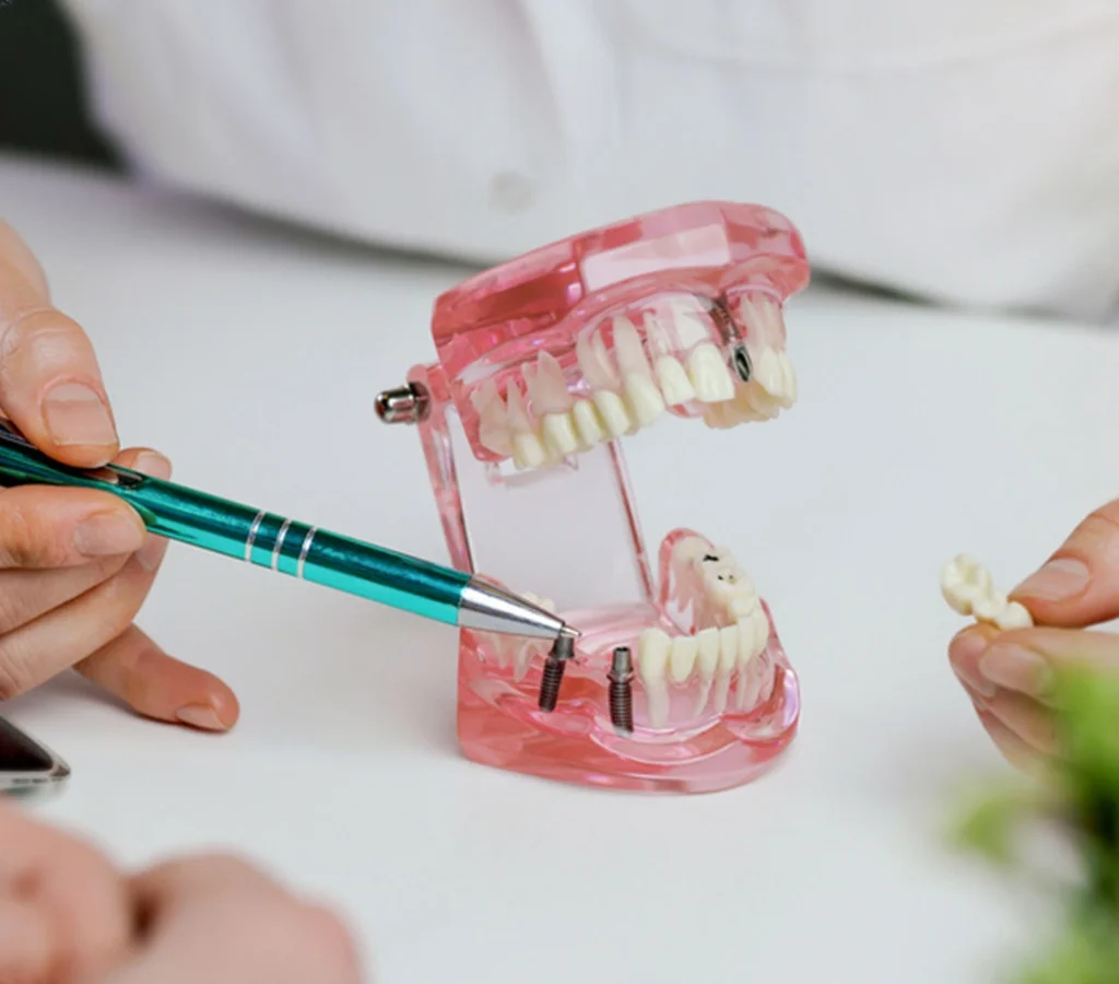 Why General Dentistry Is the Foundation of a Healthy Smile